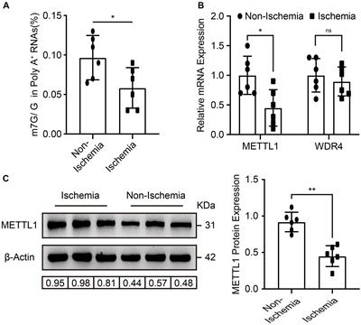 m7G Methyltransferase METTL1 Promotes Post-ischemic Angiogenesis via Promoting VEGFA mRNA Translation